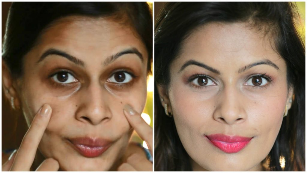 how to remove dark circles permanently