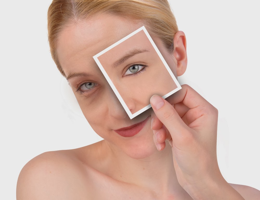 how to remove dark circles permanently